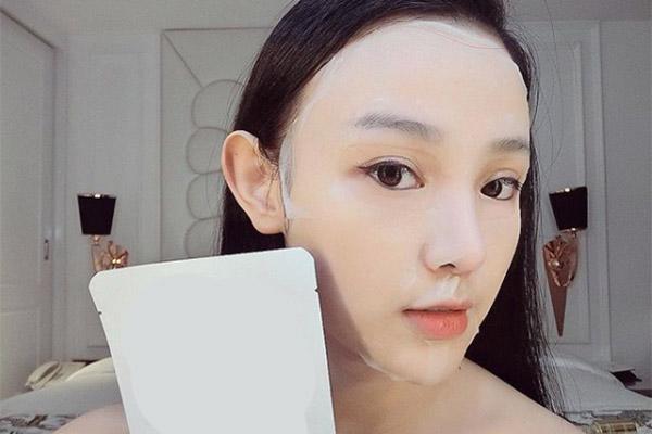 de keo dai sac xuan, me hai con huyen baby khong ngai chia se can canh tiem filler ranh moi - 8