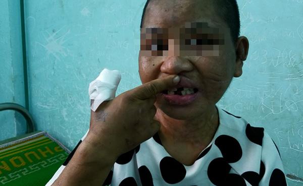 tin moi nhat vu nu giup viec 9x bi chu nha tra tan den bien dang, say thai - 2