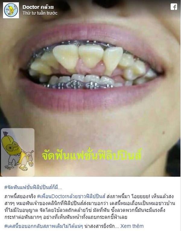 xon xao ham rang chong nguoc khien ai cung hoang hot, biet ly do lai cang dau long - 1