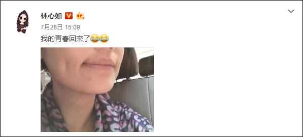 du so bi che gia, xau hon hoac kien hoa, lam tam nhu van hon nhien khoe mat... mun - 2