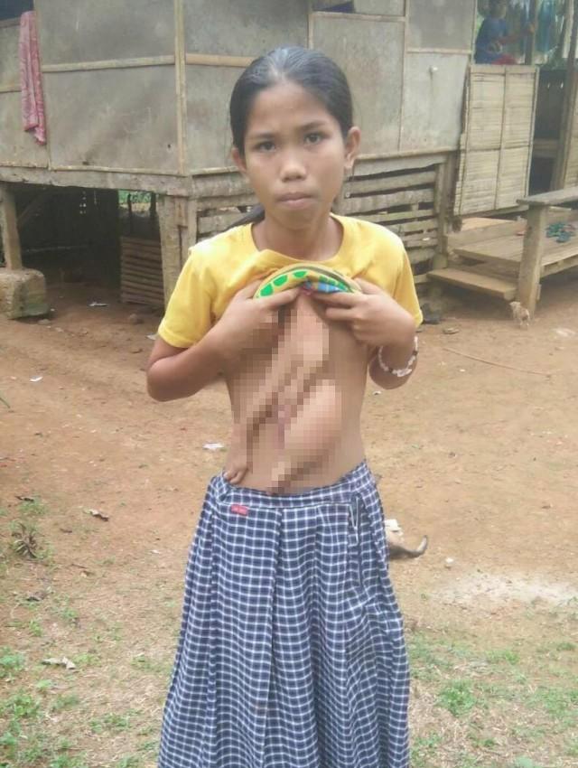 me khong kham khi mang thai, con gai co "chi em song sinh" day du tay chan dinh truoc nguc - 1