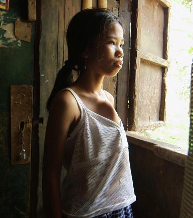 me khong kham khi mang thai, con gai co "chi em song sinh" day du tay chan dinh truoc nguc - 5