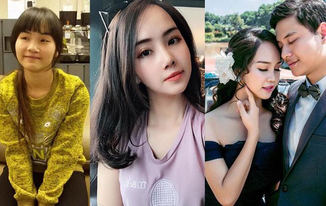 nhung co gai, chang trai viet "lot xac" nho tham my co so sinh con nhu ban goc? - 1