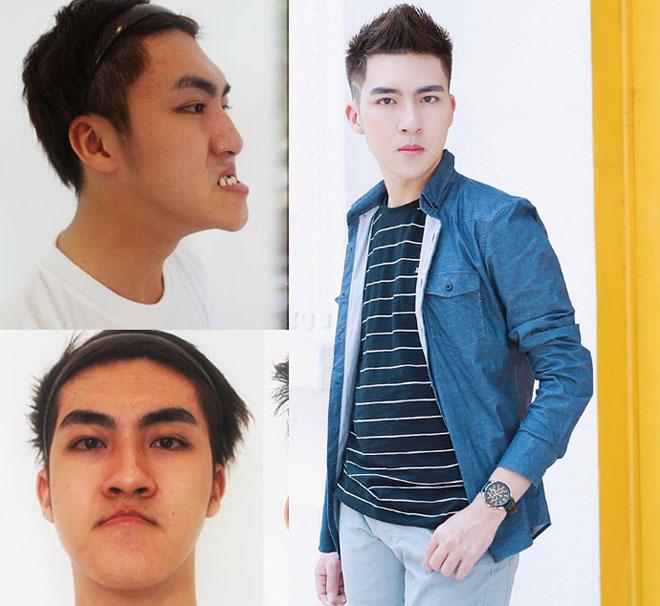 nhung co gai, chang trai viet "lot xac" nho tham my co so sinh con nhu ban goc? - 2