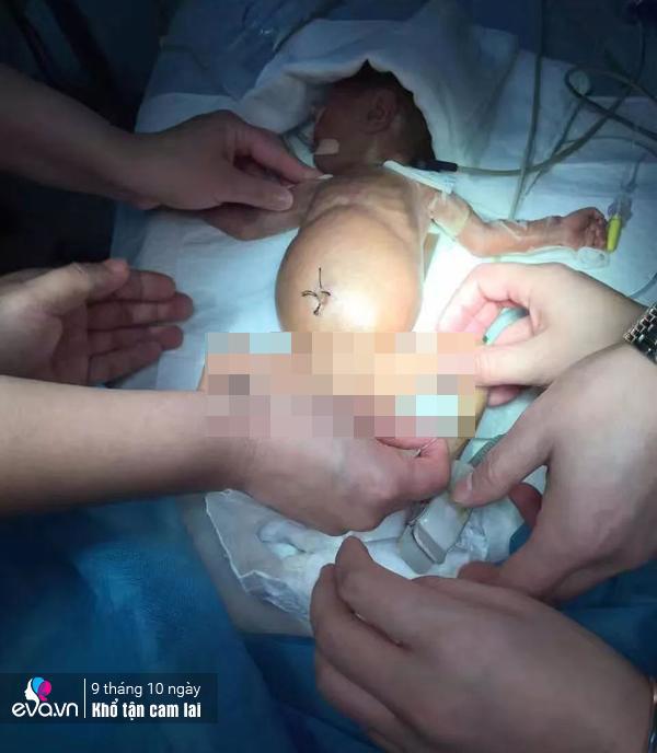 phat hien u nao khi mang thai, me 35 tuoi chon cai chet de ha sinh hai con - 4