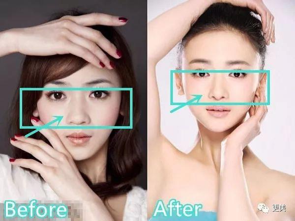 qua xinh dep, cac my nhan phim dien hy cong luoc bi "boc phot" phau thuat tham my? - 10