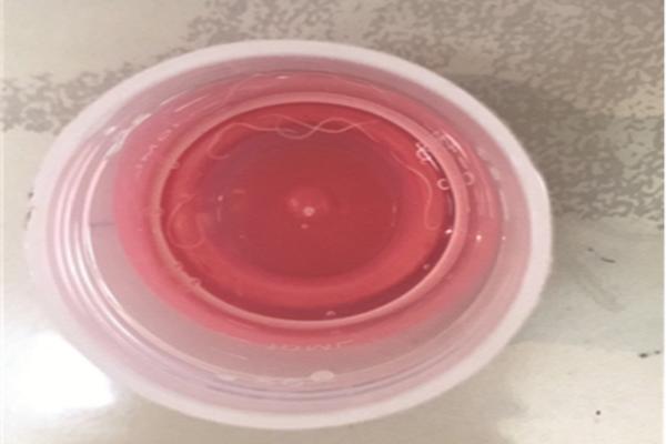 5 con giun dai ngoang song trong mat be 6 thang, nguyen do khien me viet giat minh - 1