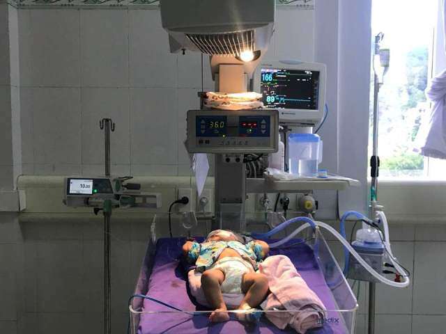 be 9 thang bi viem co tim nguy kich, ba me dung chu quan khi con co dau hieu nay - 1