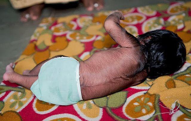 tre 10 thang tuoi da moc rau, beo phi, nghe thong bao cua bac si cha me khoc nuc no - 4