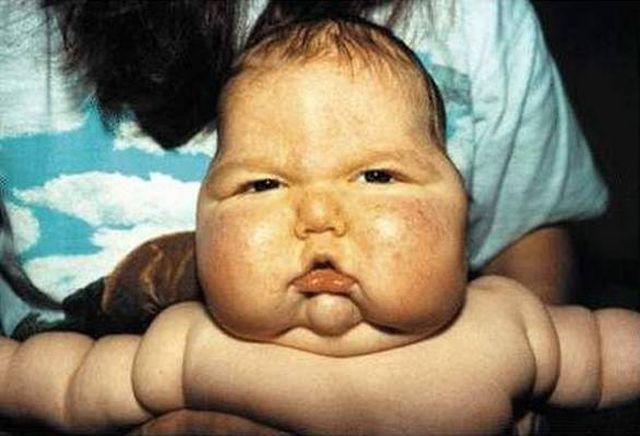 tre 10 thang tuoi da moc rau, beo phi, nghe thong bao cua bac si cha me khoc nuc no - 1