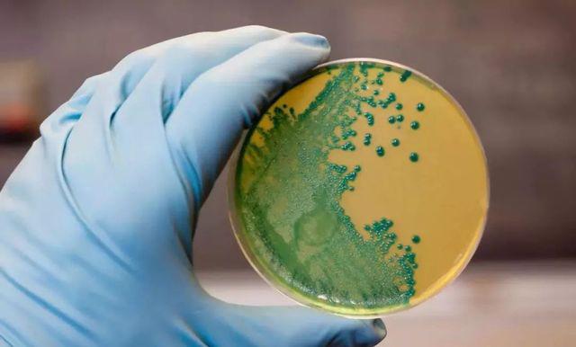 Nhiễm vi khuẩn Listeria monocytogenes rất nguy hiểm