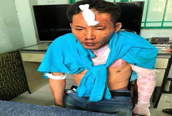 vu 2 be gai bi nguoi tinh cua me thieu chet: chuyen nguoi dan ba cuu vot ga con do - 3