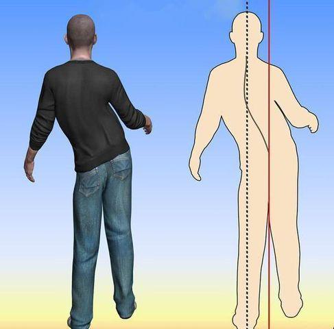 nguoi dan ong chet sau 3 gio dau dau, bac si canh bao 4 dau hieu can duoc chu y - 8