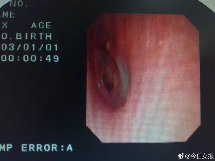 hi huu: chang trai tre thung mang nhi, suyt diec vi duoc ban gai hon - 2